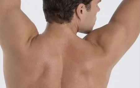 LASER HAIR REMOVAL FULL BACK & SHOULDERS